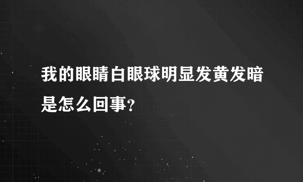 我的眼睛白眼球明显发黄发暗是怎么回事？