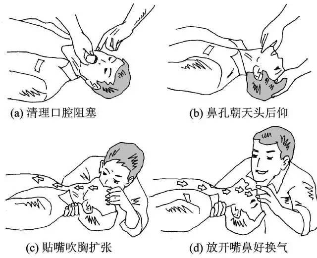 最早采用人工呼吸方法救人的医学家是