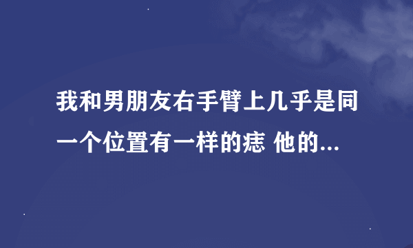 我和男朋友右手臂上几乎是同一个位置有一样的痣 他的大一点 有什么说法嘛 我俩的感情一般吧！