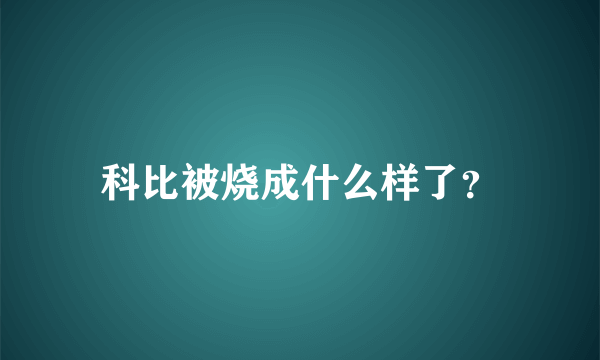 科比被烧成什么样了？