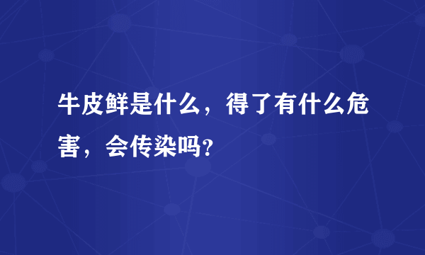 牛皮鲜是什么，得了有什么危害，会传染吗？