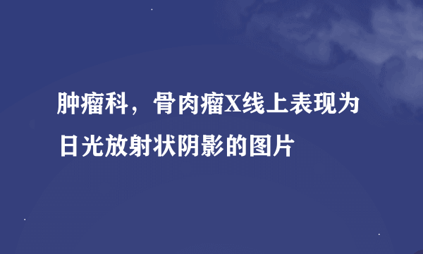 肿瘤科，骨肉瘤X线上表现为日光放射状阴影的图片