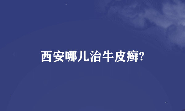 西安哪儿治牛皮癣?