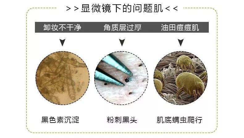 黑头和粉刺有什么区别？谢谢了，大神帮忙啊