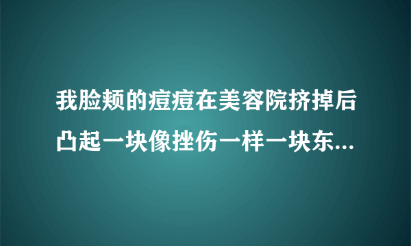 我脸颊的痘痘在美容院挤掉后凸起一块像挫伤一样一块东西，怎么回事？