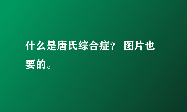 什么是唐氏综合症？ 图片也要的。