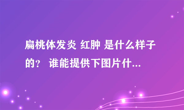 扁桃体发炎 红肿 是什么样子的？ 谁能提供下图片什么的 供参考 谢谢