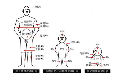 成人的体表面积怎么算