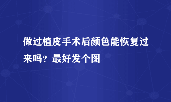 做过植皮手术后颜色能恢复过来吗？最好发个图