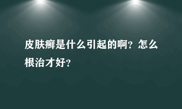 皮肤癣是什么引起的啊？怎么根治才好？